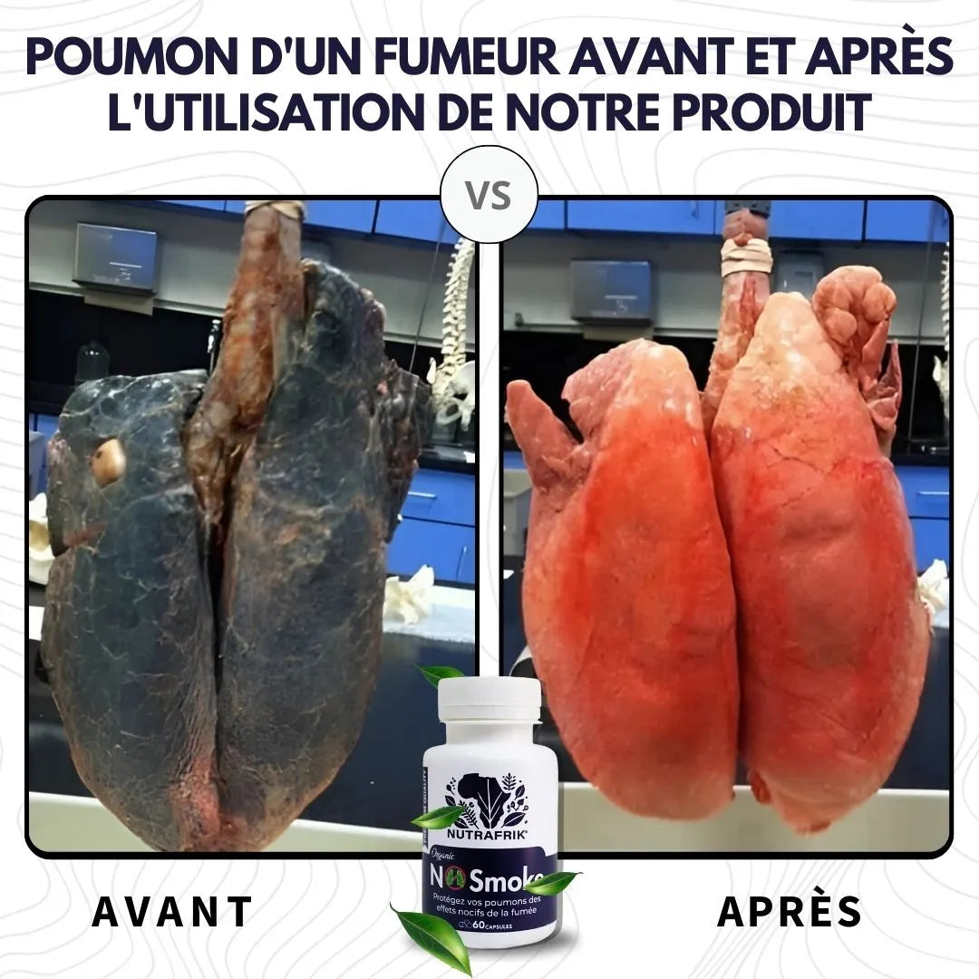 Complément Alimentaire Anti-Tabac