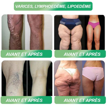 GLP-1 Six en Un : le secret pour mincir naturellement