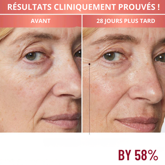 Astaxanthine 12 mg, 120 capsules molles, approvisionnement de 4 mois