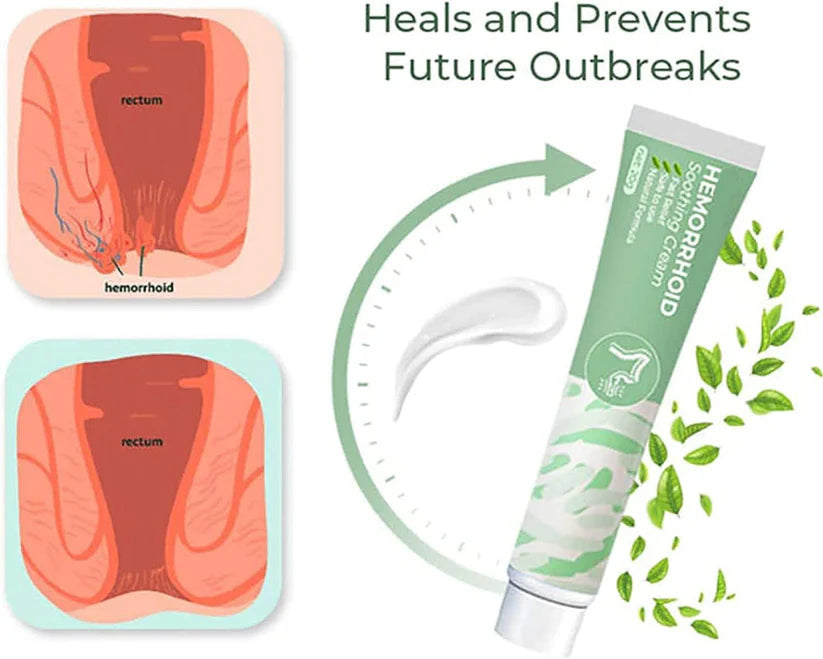 Crème à base de plantes pour hémorroïdes