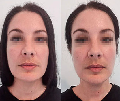 Drainage Lymphatique Liquide – Visage Affiné, Jambes Légères, Ventre Plat
